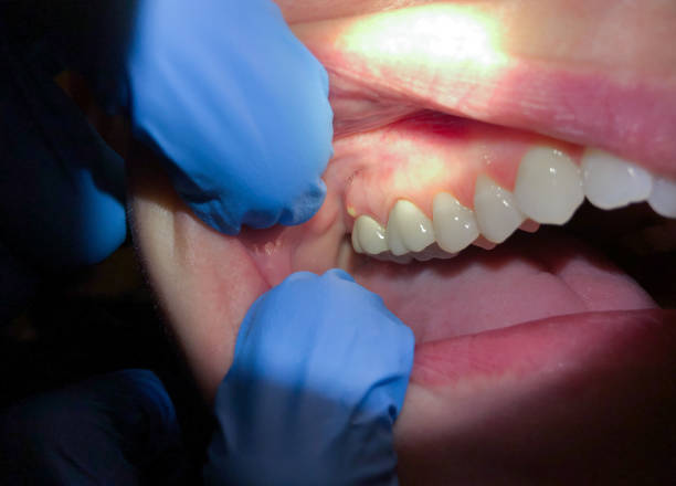 Best Urgent Dental Care for Toothache in Hannahs Mill, GA