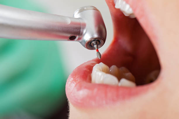 Best Mobile Emergency Dentist in Hannahs Mill, GA